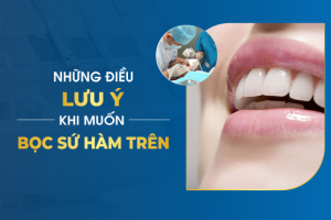 KIẾN THỨC BỌC RĂNG SỨ