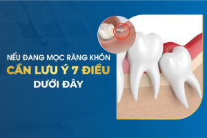 KIẾN THỨC TỔNG HỢP